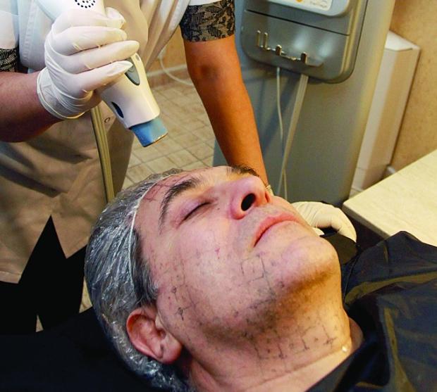 Орлин Горанов по време на процедура за изглаждане на бръчките.