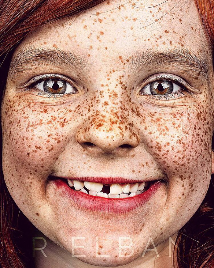 1 freckles-portrait-photography-brock-elbank-135__700