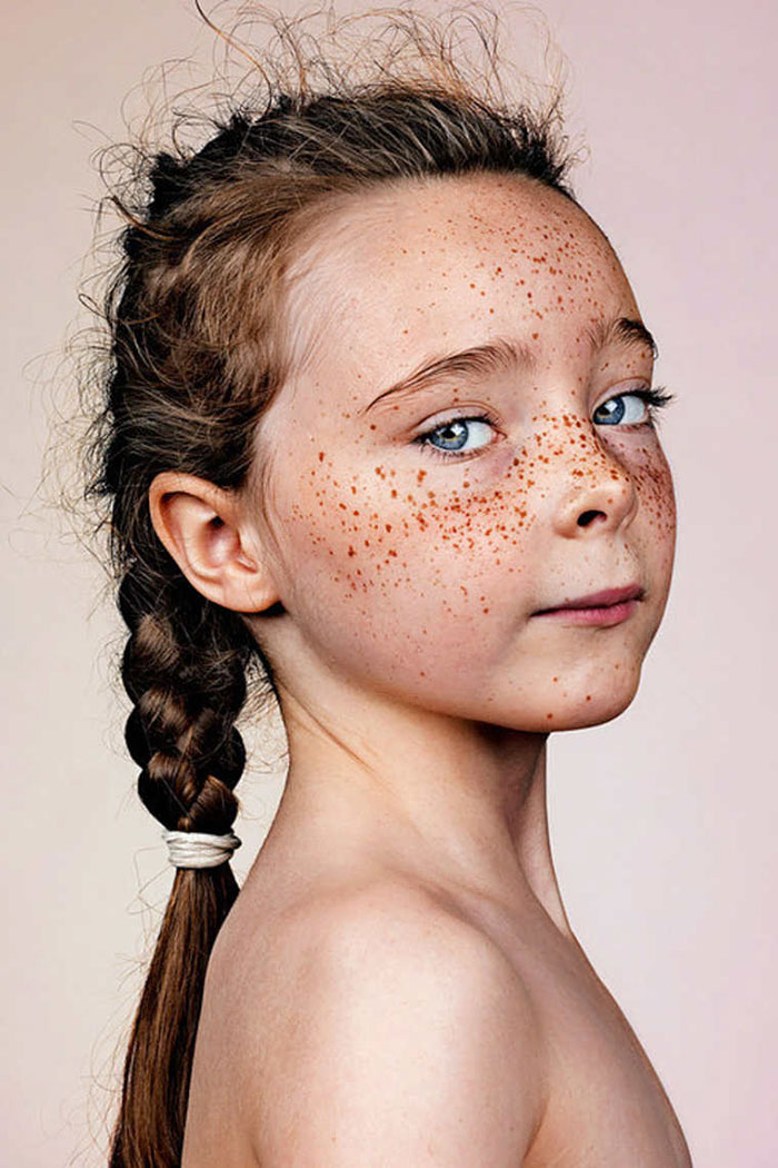 freckles-portrait-photography-brock-elbank-127__700