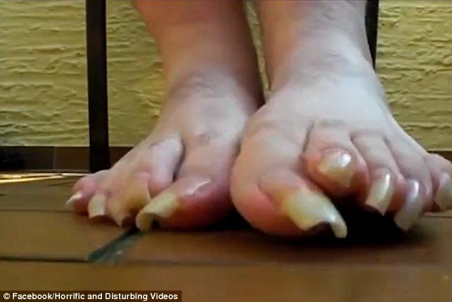 Bilderesultat for longest toenails in the world